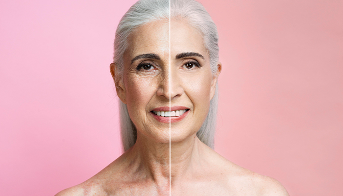 Botox Prices in Turkey 2025 Botox Prices in Turkey 2025