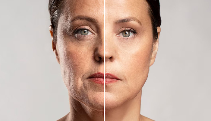 Facelift Prices in Turkey 2023 Facelift Prices in Turkey 2023