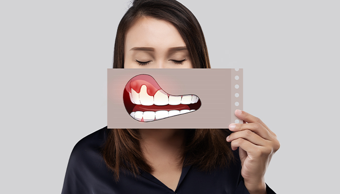 Gum Disease Treatment Prices in Turkey 2023 Gum Disease Treatment Prices in Turkey 2023