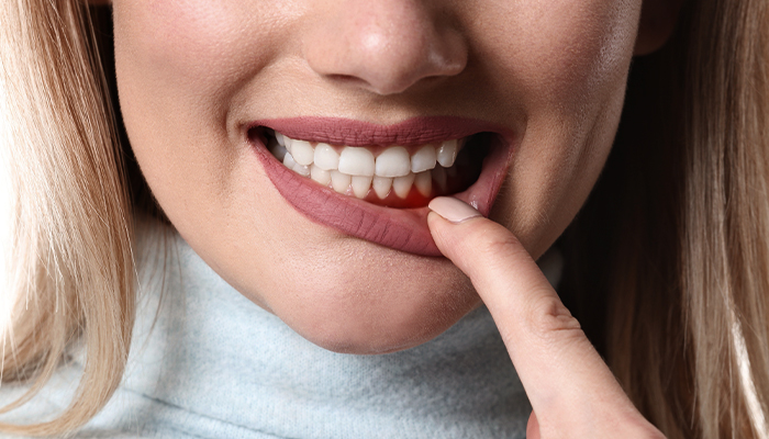 Gum Disease Treatment Prices in Turkey 2023 Gum Disease Treatment Prices in Turkey 2023