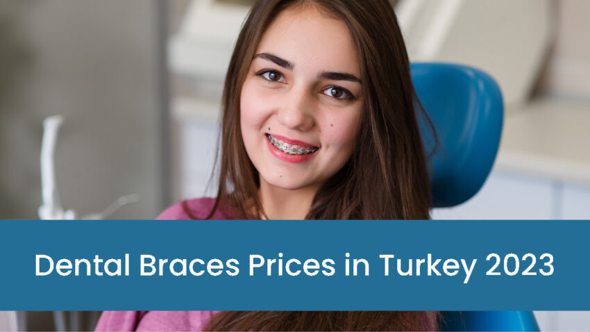 Dental Braces Prices in Turkey 2023