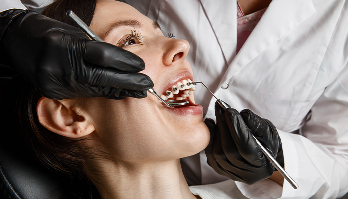 Dental Braces Prices in Turkey 2023 Dental Braces Prices in Turkey 2023