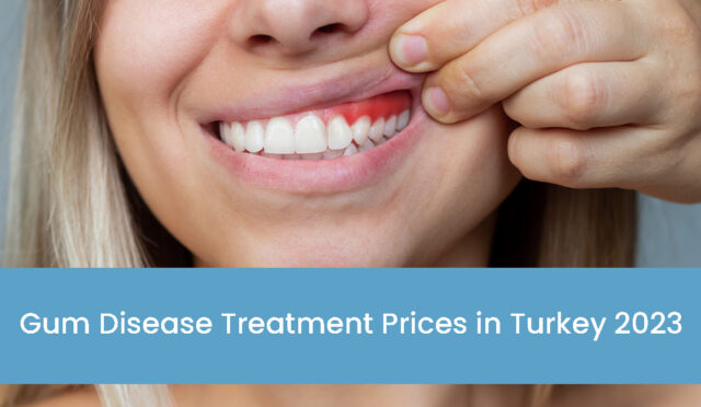 gum-disease-treatment-prices-in-turkey-2023