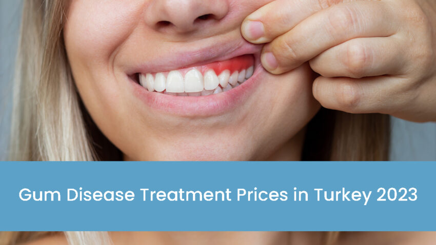 Gum Disease Treatment Prices in Turkey 2023