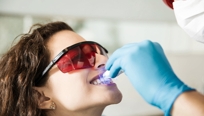 Teeth Whitening Prices in Turkey 2024