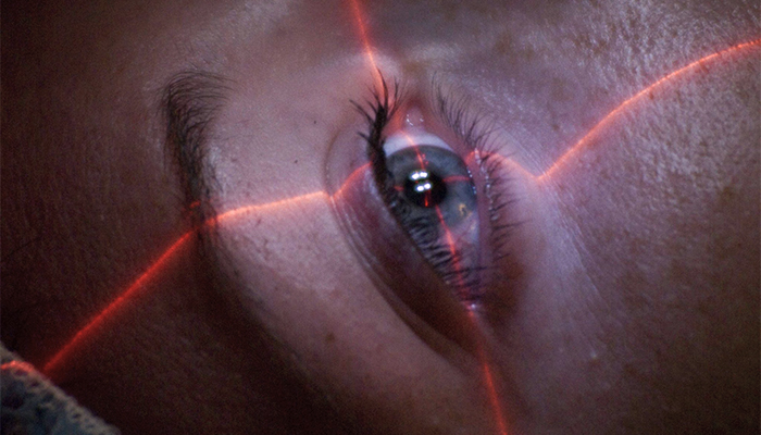 Laser Eye Surgery (Laser Vision Correction) Prices in Turkey 2024 Laser Eye Surgery (Laser Vision Correction) Prices in Turkey 2024
