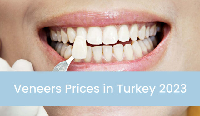veneers-prices-in-turkey-2023