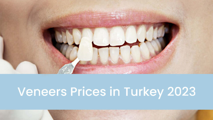 Veneers Prices in Turkey 2023
