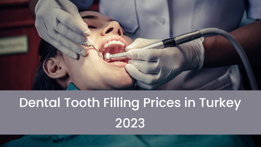 Dental Tooth Filling Prices in Turkey 2023